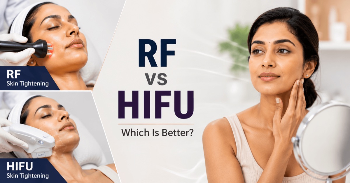 Split artwork comparing radiofrequency and HIFU skin tightening treatments