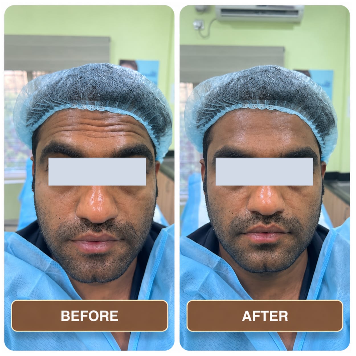 A man in a surgical cap and gown photographed front-on twice, the two shots side by side and labelled Before and After