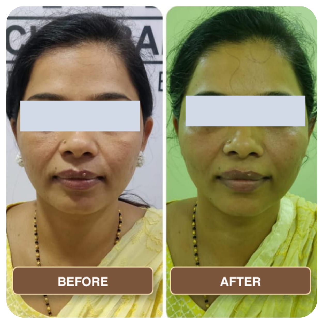 A woman in a yellow dupatta photographed front-on twice, the two shots side by side and labelled Before and After