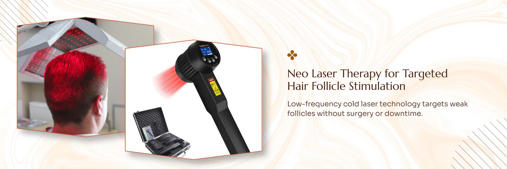 Hair Loss treatment technology and care information