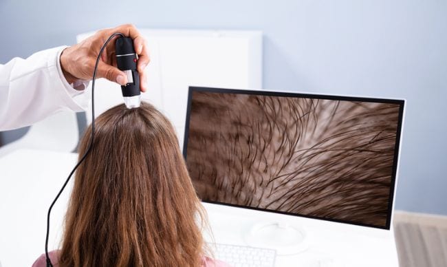 Trichoscope examining the scalp