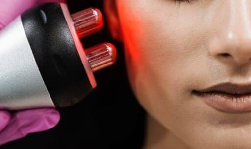 Skin tightening device on the face