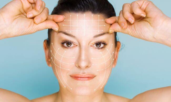 Face marked for a thread lift