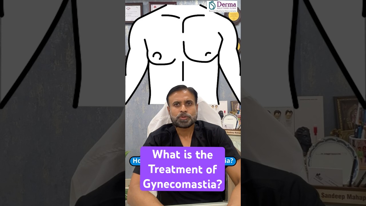 Treatment of Gynecomastia | Causes, Treatment Options & Surgery Explained |Derma Solutions Bangalore