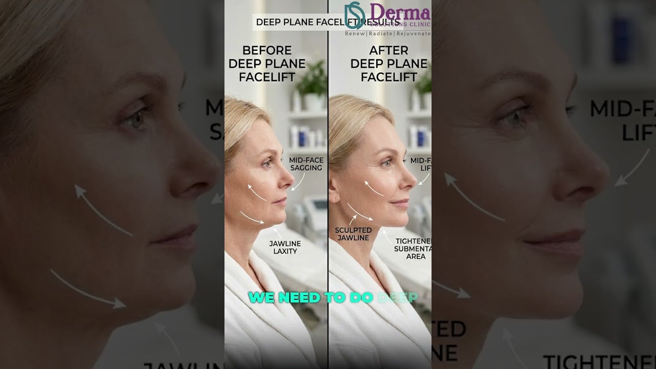 HIFU Explained: 5 Common Myths About Non-Surgical Face Lifting