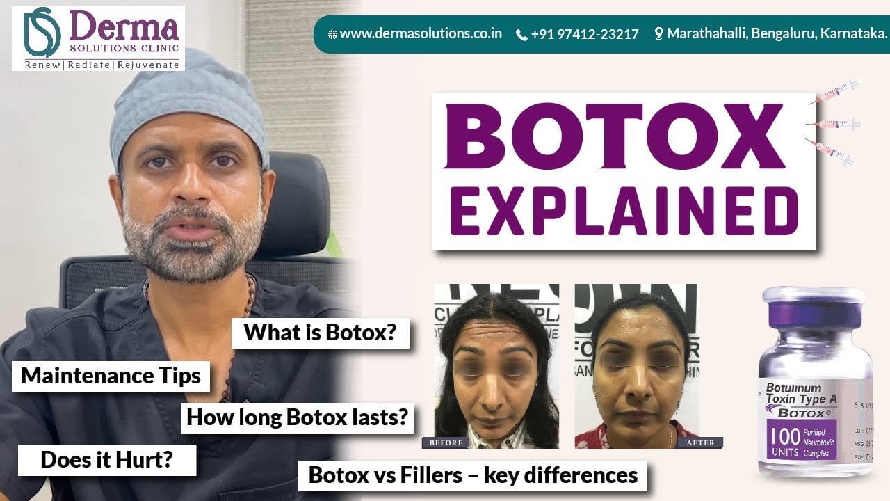 Botox Explained Simply | Benefits, Safety, Procedure & Myths | Derma Solutions Skin clinic Bangalore