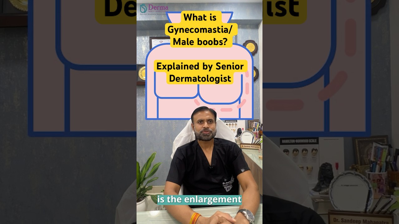 Understanding Gynecomastia | Basics Explained by Dr. Sandeep Mahapatra, Derma Solutions skin clinic!