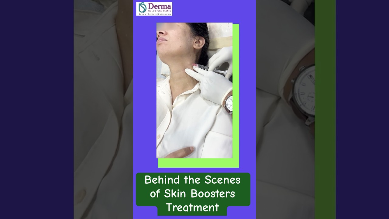 Skin Boosters: Behind the scenes of a Profhilo Treatment! Derma Solutions clinic, Bengaluru #bts