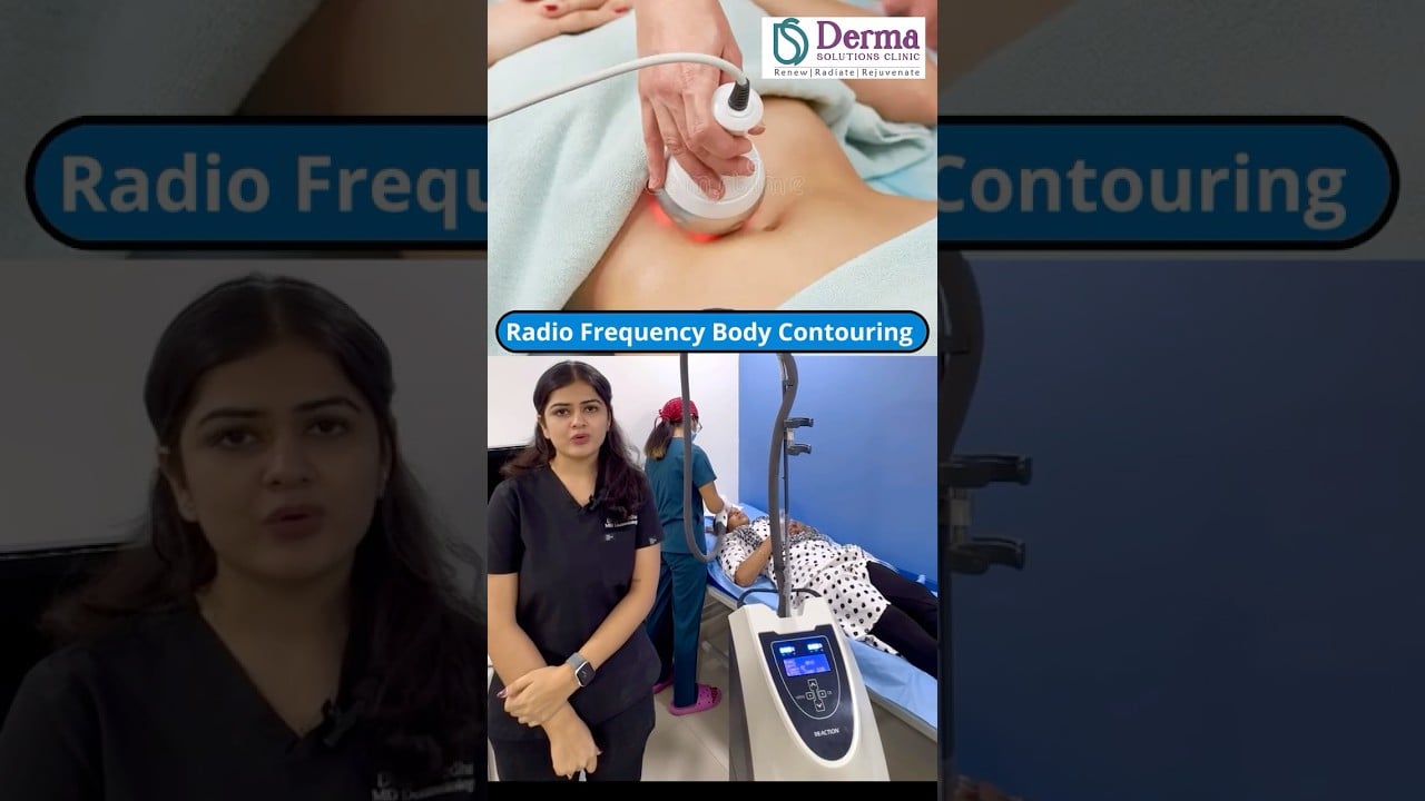 Radio Frequency Skin Tightening with Reaction Viora at Derma Solutions Skin Clinic, Bangalore