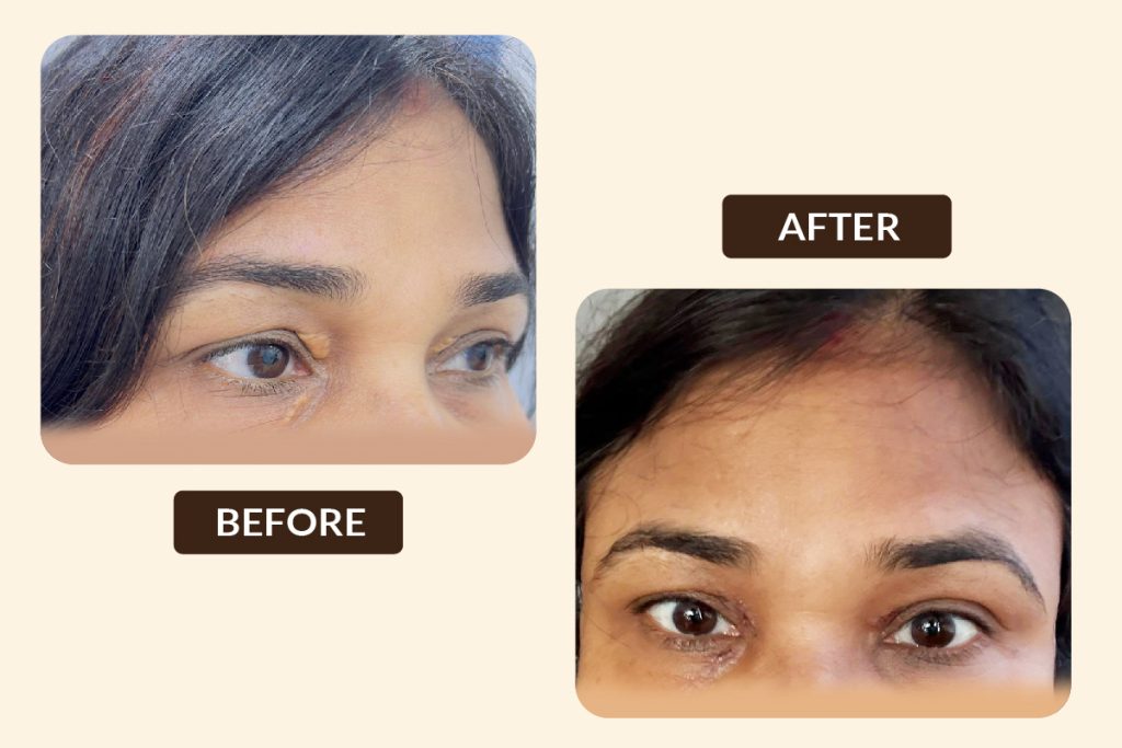 BEFORE AFTER PHOTOS