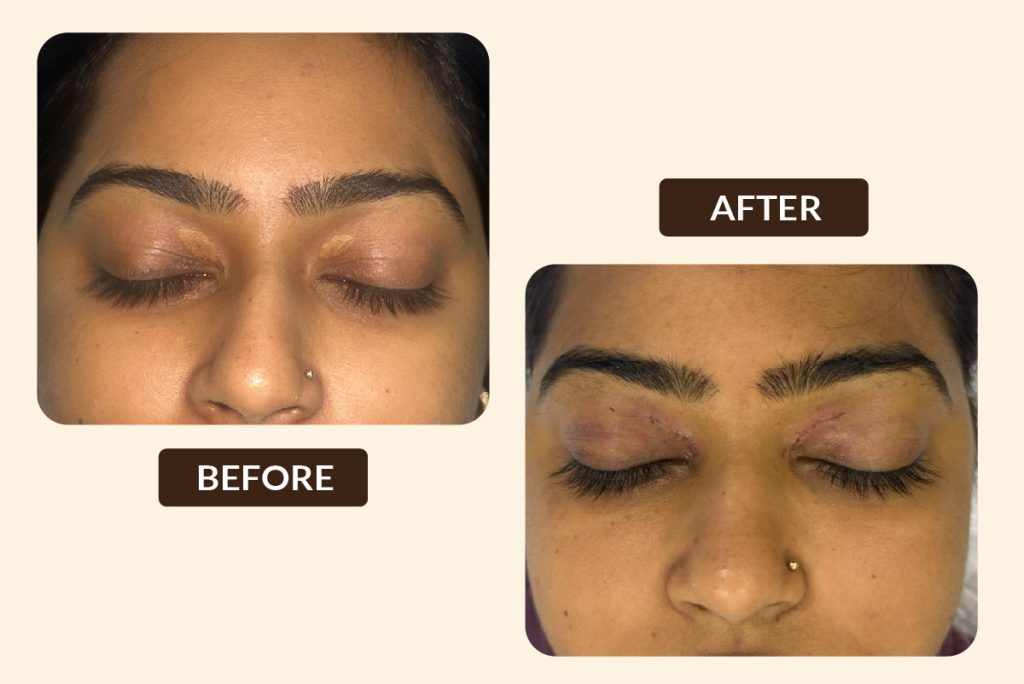 BEFORE AFTER PHOTOS