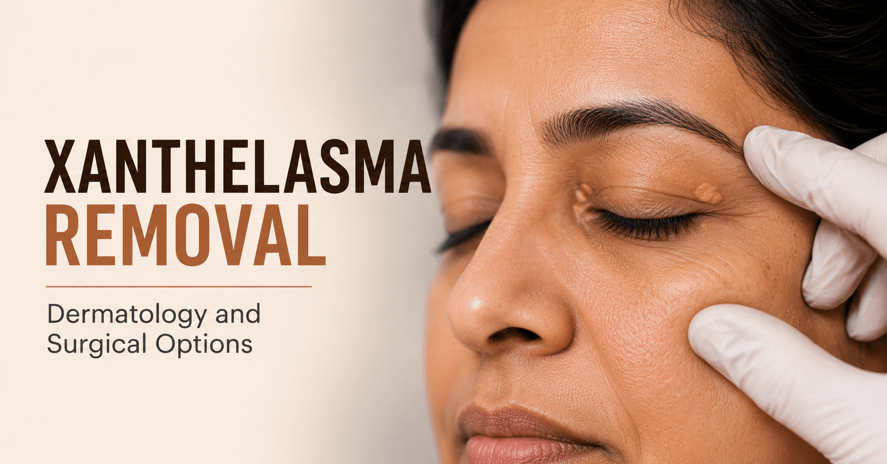 Xanthelasma Removal in Bengaluru